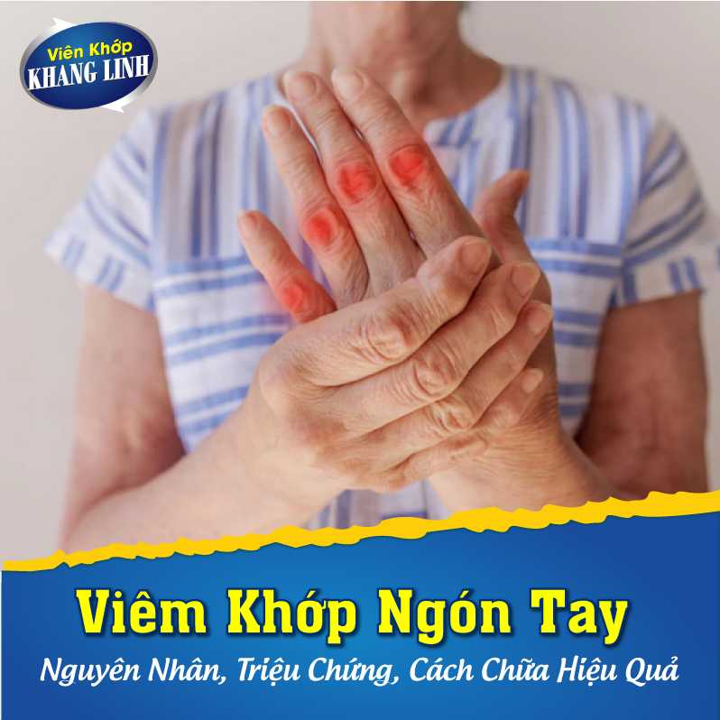 Viêm khớp ngón tay là tình trạng thoái hóa, khi sụn đầu khớp bị bào mòn, dẫn đến cơn đau nhức và làm giảm khả năng vận động