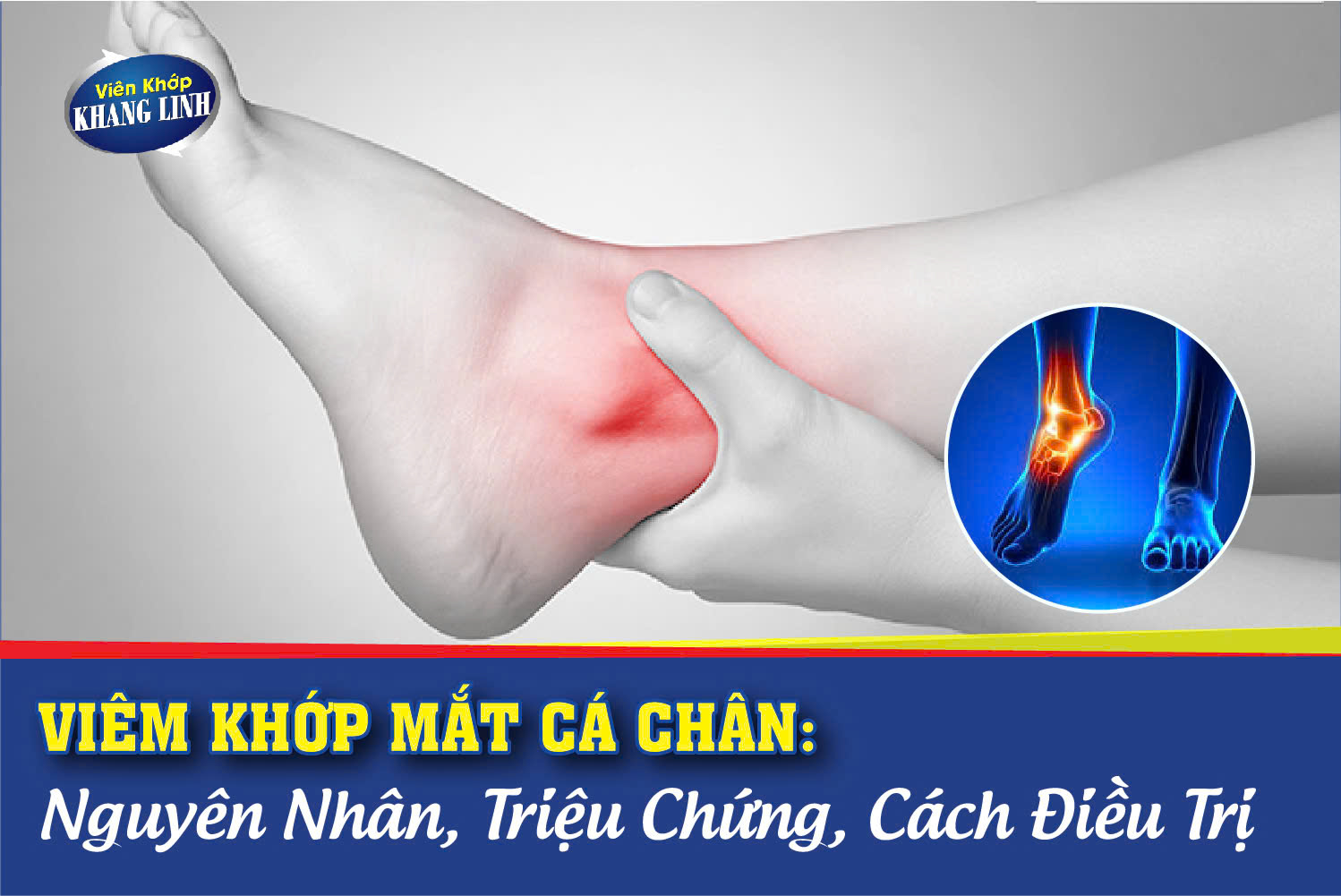 Bệnh viêm khớp mắt cá chân thường xuất hiện ở người trung niên